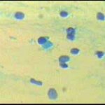 Κύτταρα ενδοτραχήλου, μεγέθυνση 10Χ40